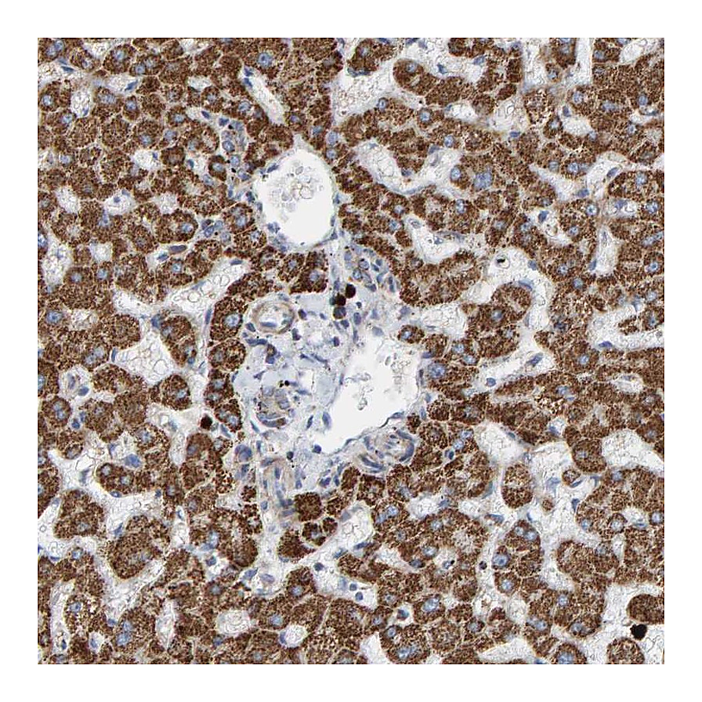 Atlas Antibodies Anti-B9D1 Antibody