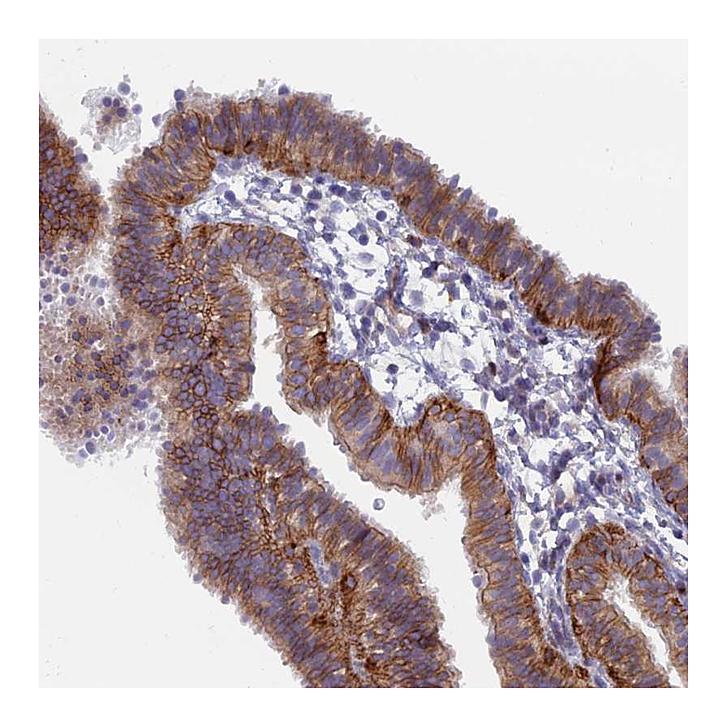 Atlas Antibodies Anti-B9D2 Antibody
