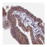 Atlas Antibodies Anti-B9D2 Antibody
