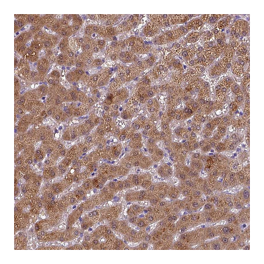 Atlas Antibodies Anti-BAAT Antibody