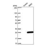 Atlas Antibodies Anti-B9D2 Antibody