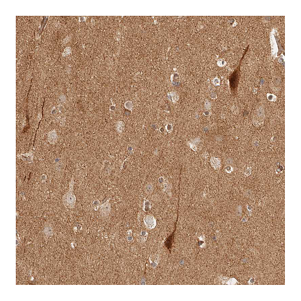 Atlas Antibodies Anti-BAALC Antibody