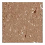 Atlas Antibodies Anti-BAALC Antibody