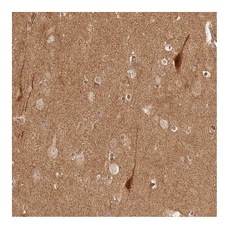 Atlas Antibodies Anti-BAALC Antibody