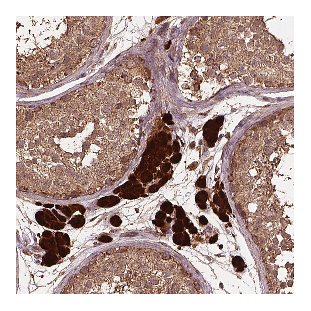 Atlas Antibodies Anti-BABAM1 Antibody