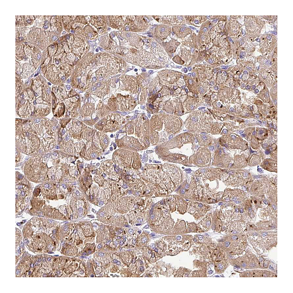 Atlas Antibodies Anti-BACE2 Antibody