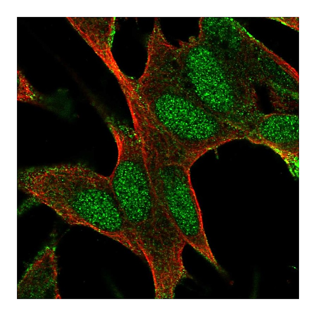 Atlas Antibodies Anti-BAALC Antibody
