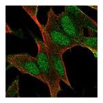 Atlas Antibodies Anti-BAALC Antibody