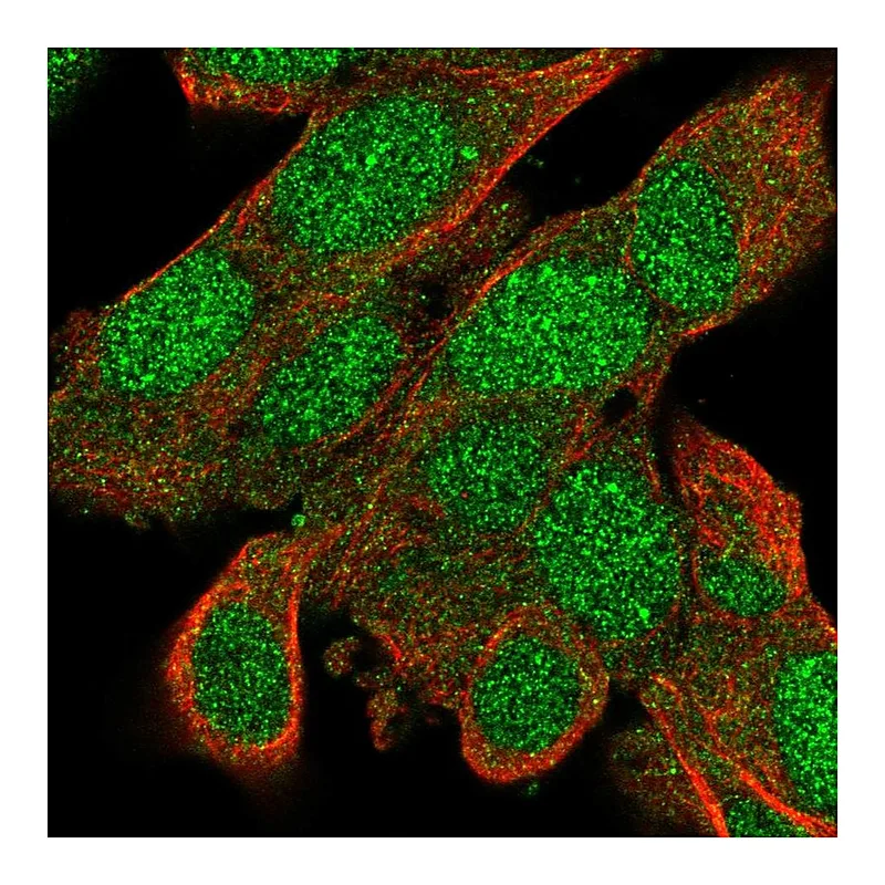 Atlas Antibodies Anti-BACH2 Antibody