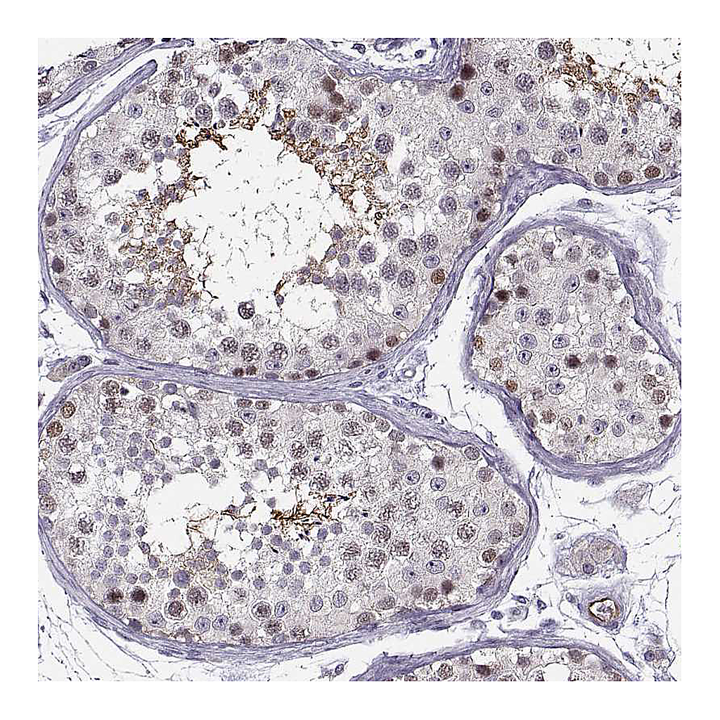 Atlas Antibodies Anti-BACH1 Antibody