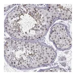 Atlas Antibodies Anti-BACH1 Antibody