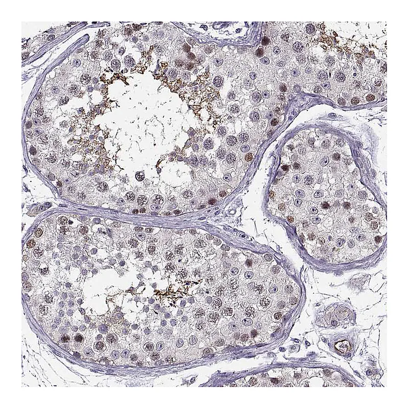 Atlas Antibodies Anti-BACH1 Antibody