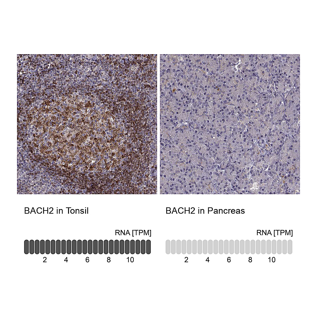 Atlas Antibodies Anti-BACH2 Antibody