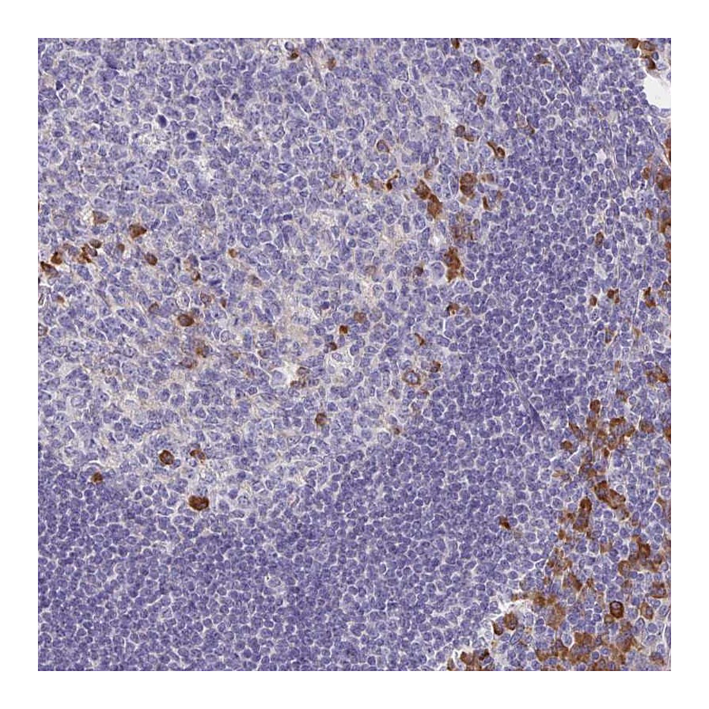 Atlas Antibodies Anti-BAD Antibody