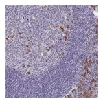 Atlas Antibodies Anti-BAD Antibody