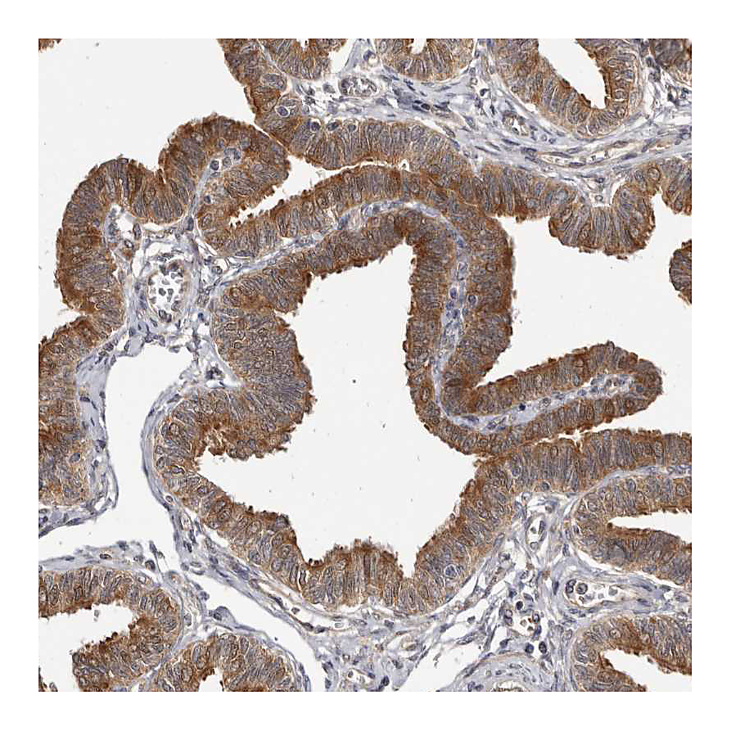 Atlas Antibodies Anti-BAD Antibody
