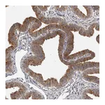 Atlas Antibodies Anti-BAD Antibody