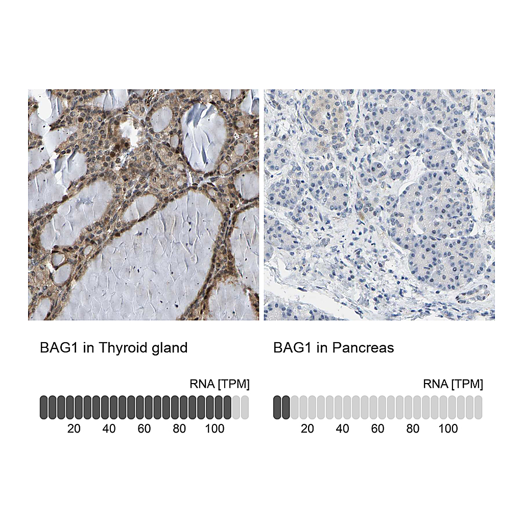 Atlas Antibodies Anti-BAG1 Antibody