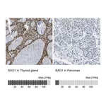 Atlas Antibodies Anti-BAG1 Antibody