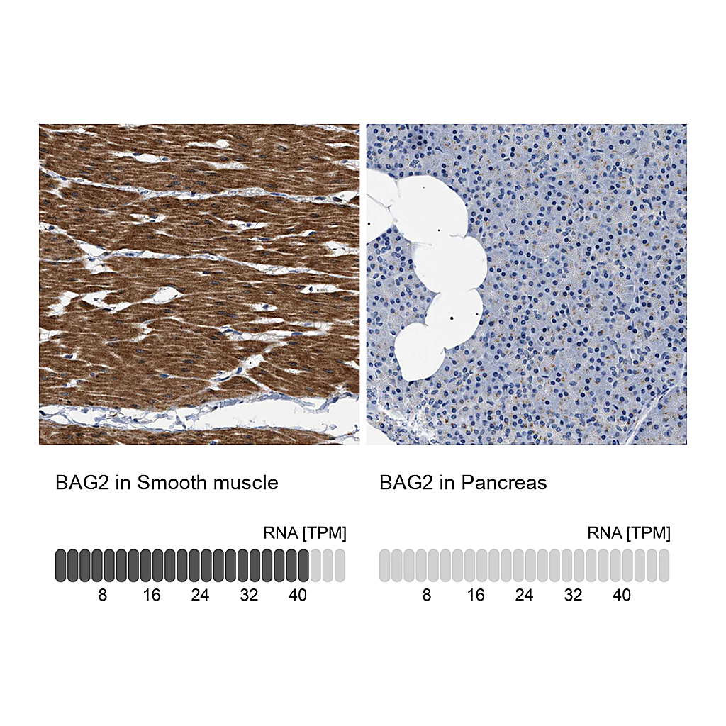 Atlas Antibodies Anti-BAG2 Antibody