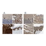 Atlas Antibodies Anti-BAG3 Antibody