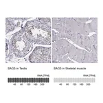 Atlas Antibodies Anti-BAG5 Antibody