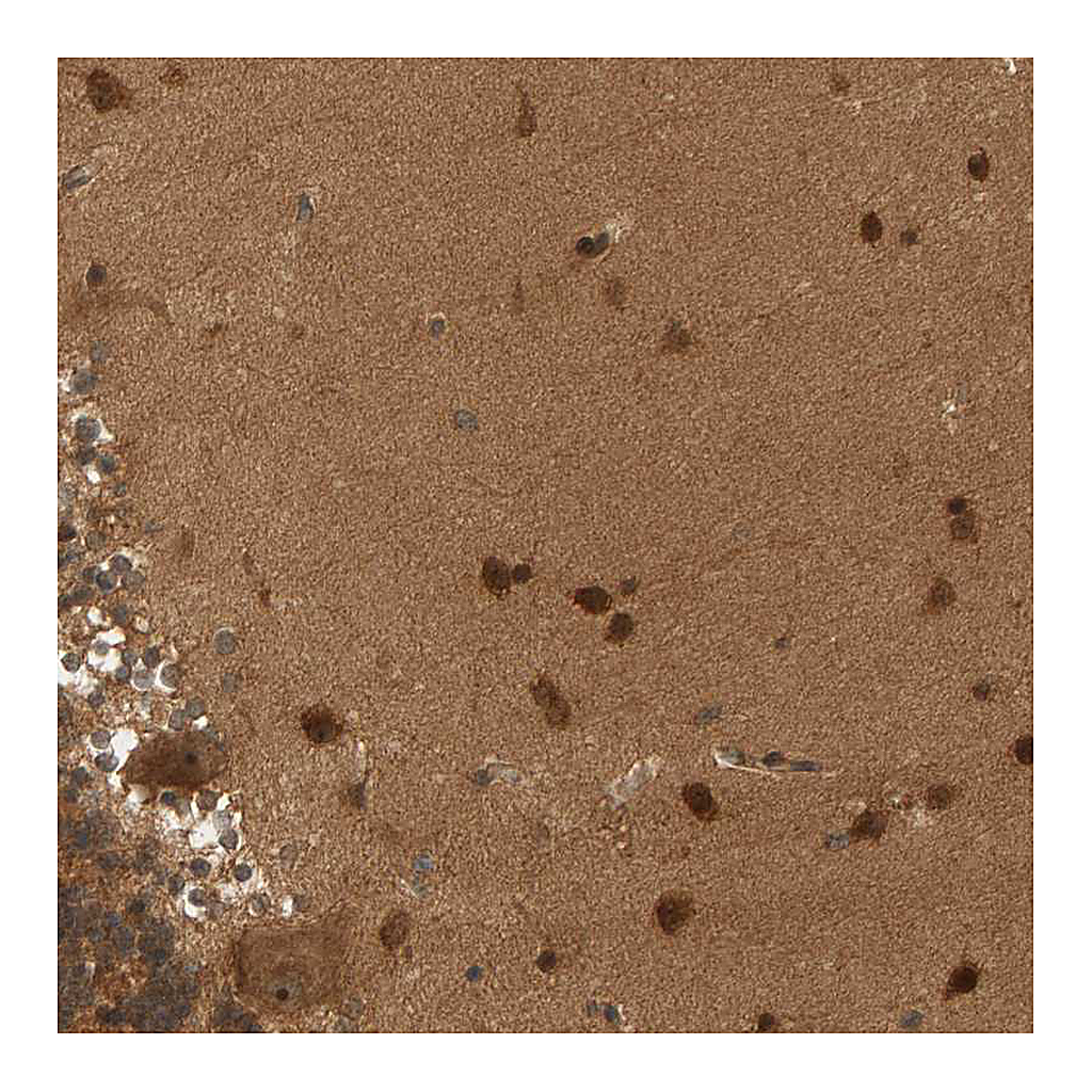 Atlas Antibodies Anti-BAHCC1 Antibody