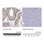 Atlas Antibodies Anti-BAG6 Antibody