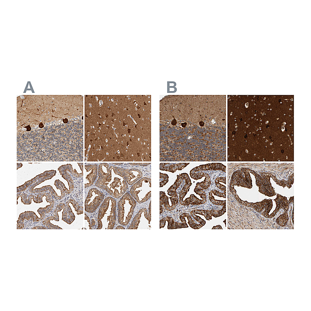Atlas Antibodies Anti-BAIAP2 Antibody