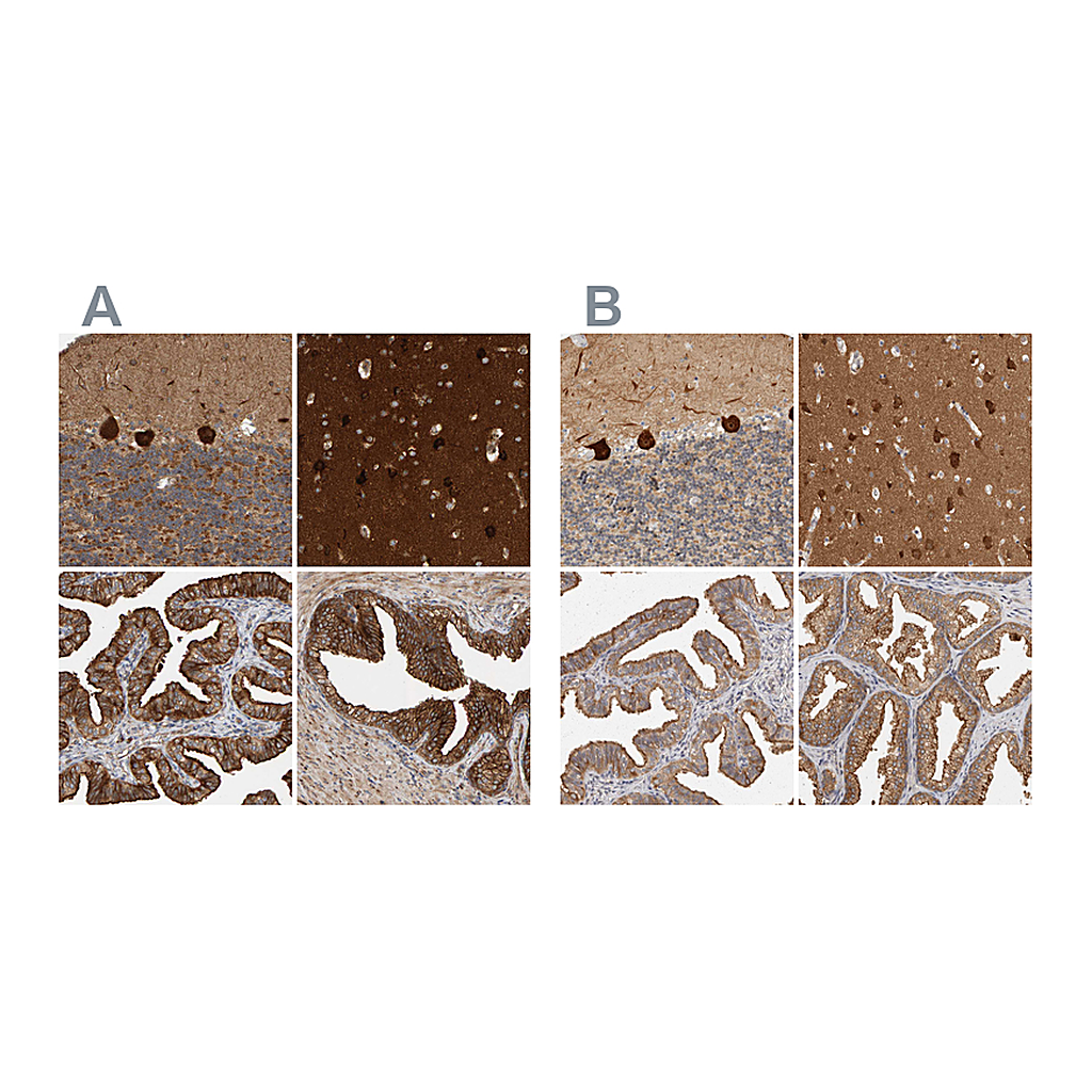 Atlas Antibodies Anti-BAIAP2 Antibody