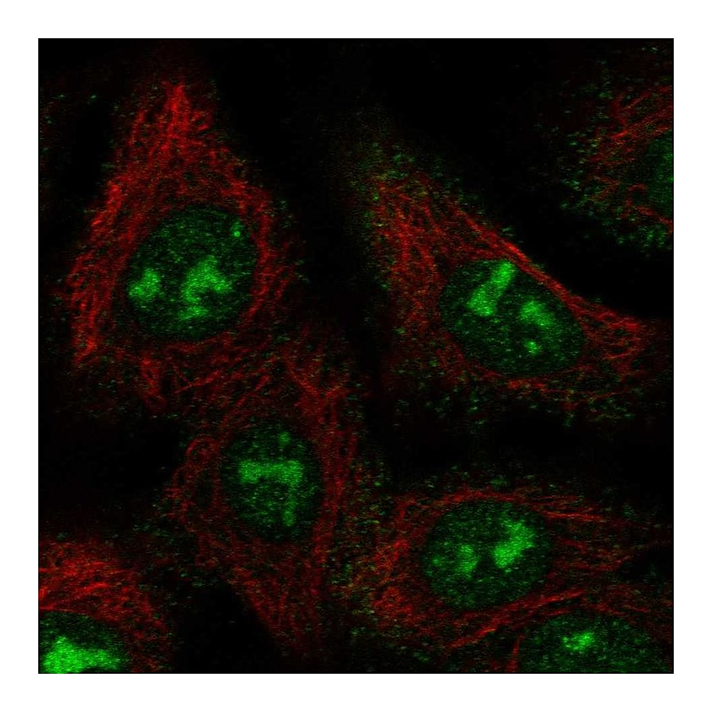 Atlas Antibodies Anti-BAHCC1 Antibody