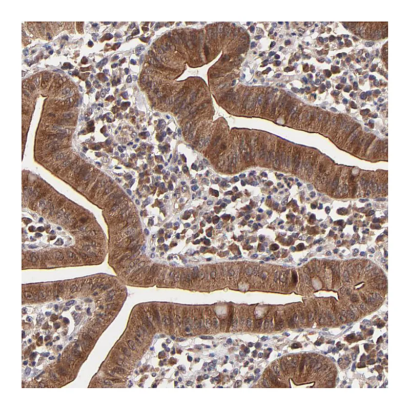 Atlas Antibodies Anti-BAIAP2L2 Antibody
