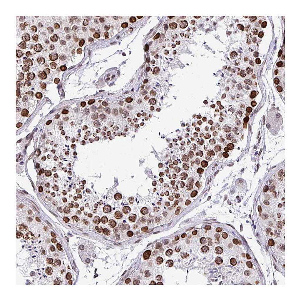 Atlas Antibodies Anti-BANF1 Antibody