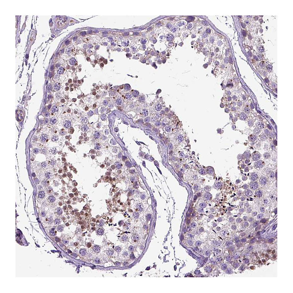 Atlas Antibodies Anti-BANF2 Antibody