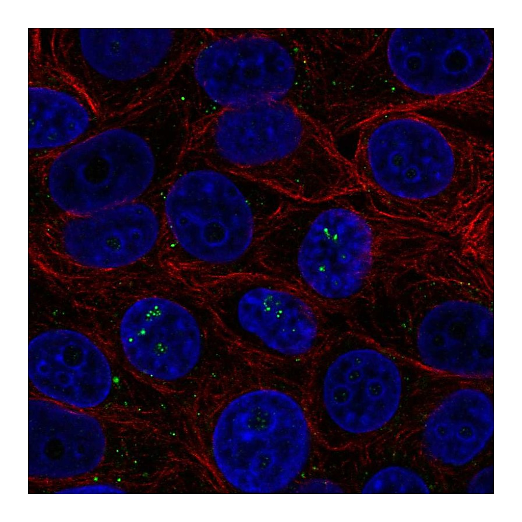 Atlas Antibodies Anti-BAMBI Antibody