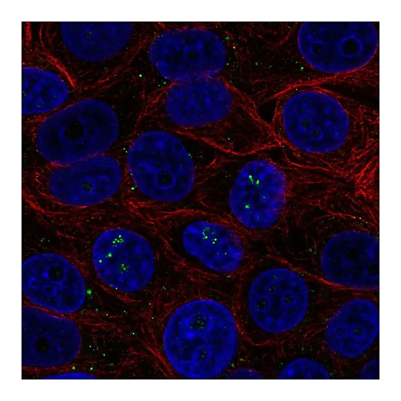 Atlas Antibodies Anti-BAMBI Antibody