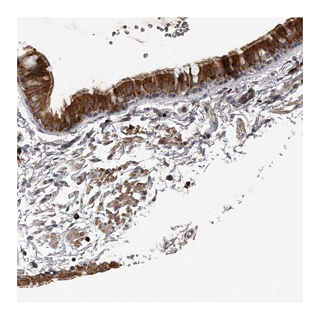 Atlas Antibodies Anti-BAMBI Antibody