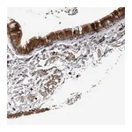Atlas Antibodies Anti-BAMBI Antibody