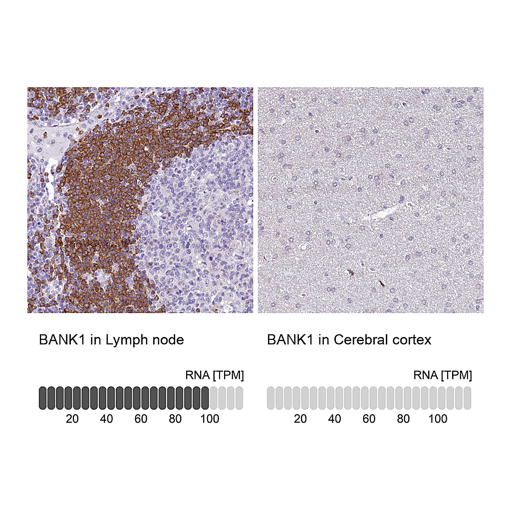 Atlas Antibodies Anti-BANK1 Antibody