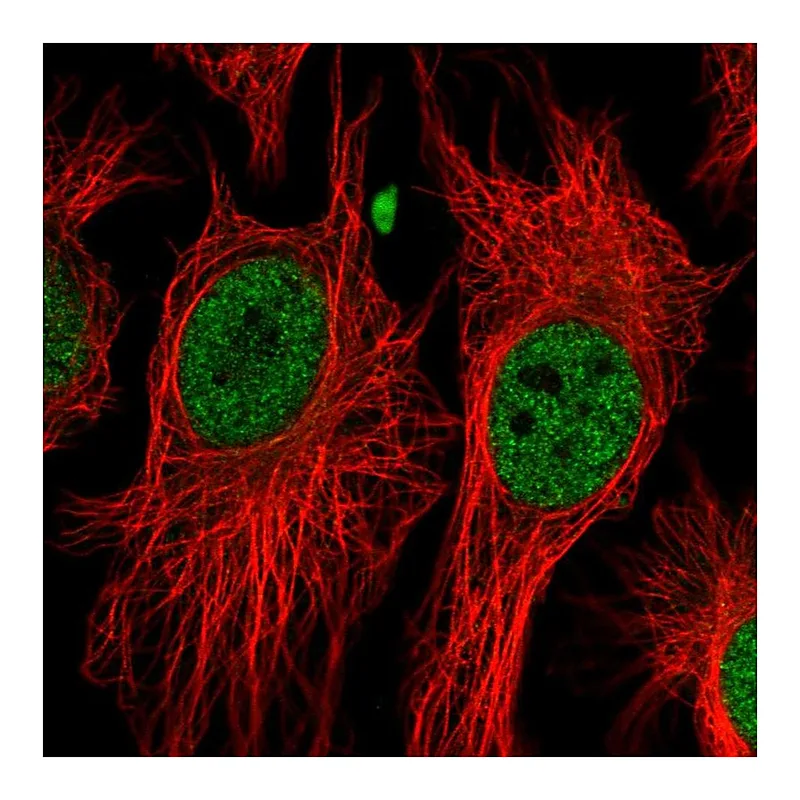 Atlas Antibodies Anti-BAP1 Antibody