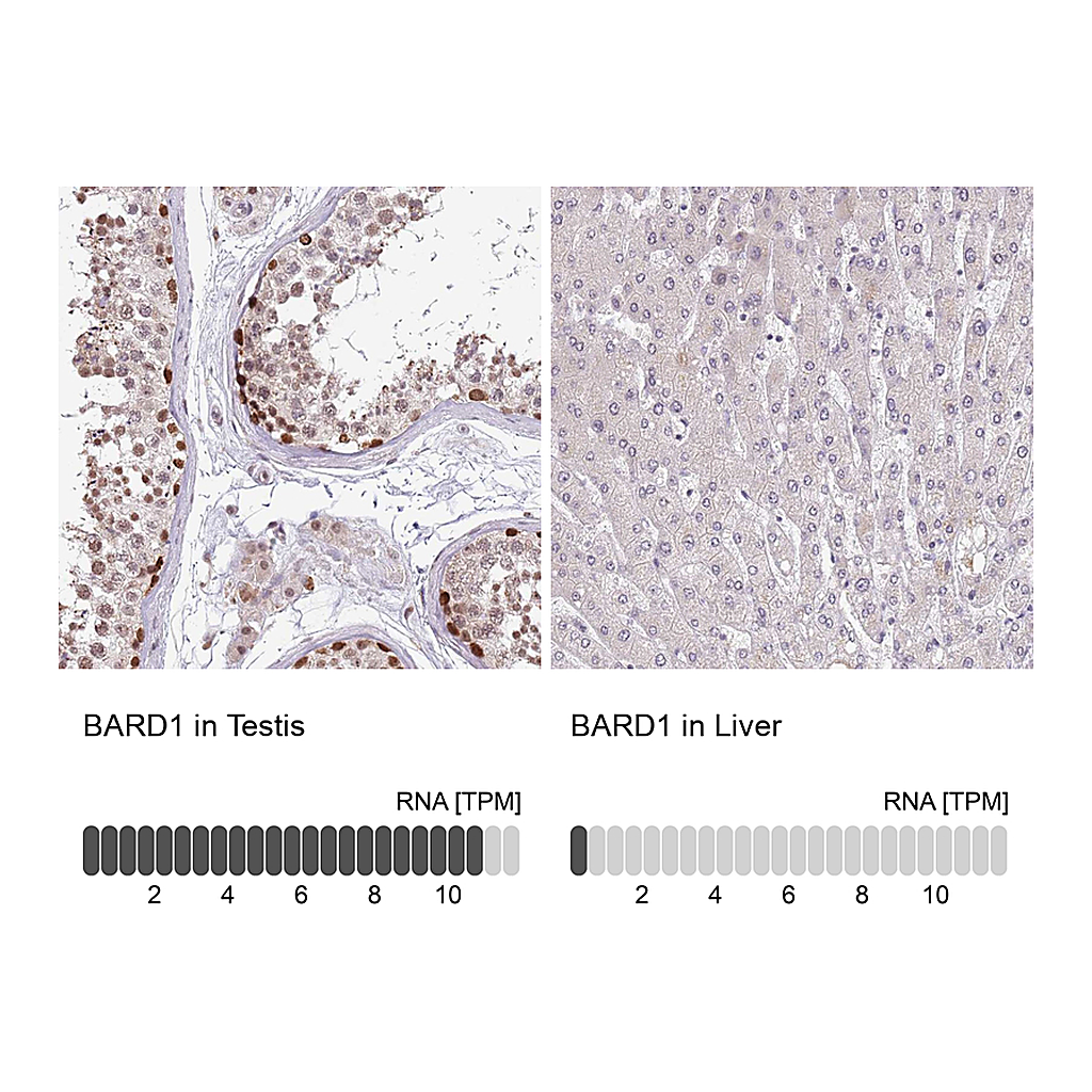 Atlas Antibodies Anti-BARD1 Antibody