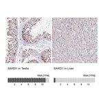 Atlas Antibodies Anti-BARD1 Antibody