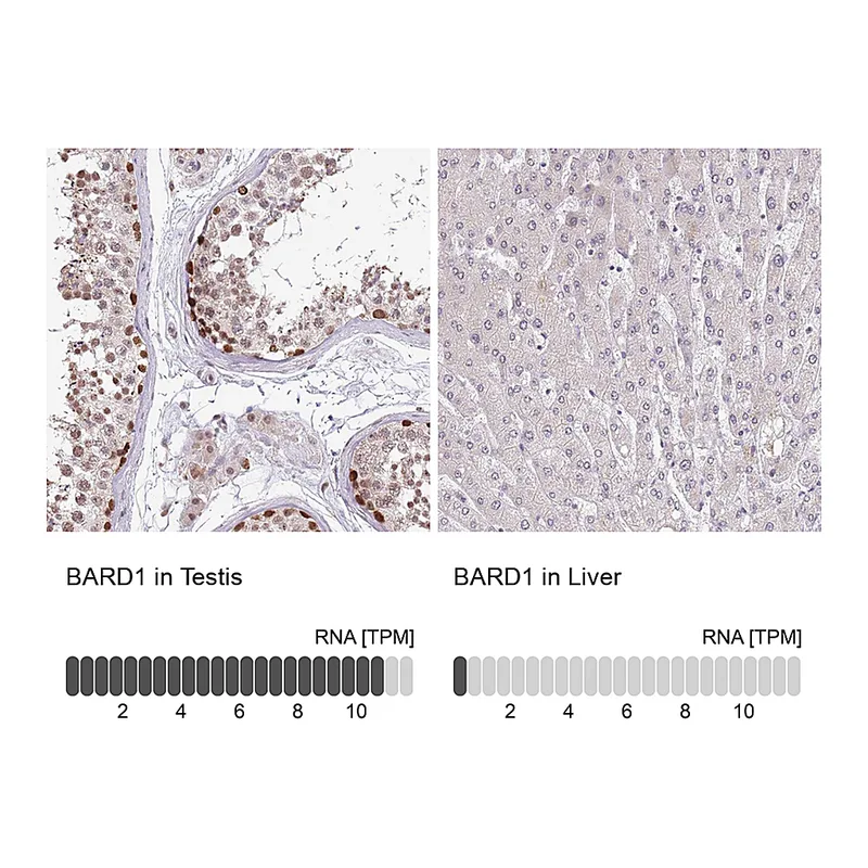Atlas Antibodies Anti-BARD1 Antibody