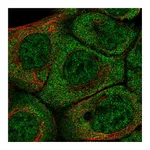 Atlas Antibodies Anti-BARX2 Antibody