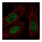 Atlas Antibodies Anti-BAP1 Antibody