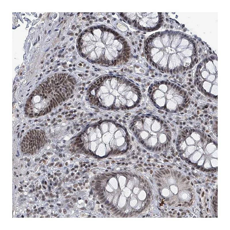 Atlas Antibodies Anti-BANP Antibody