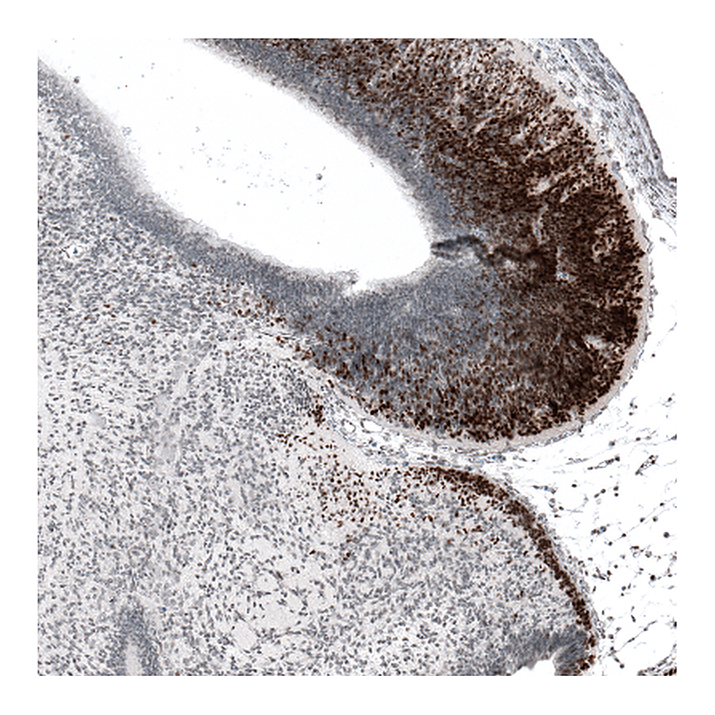 Atlas Antibodies Anti-BARHL1 Antibody