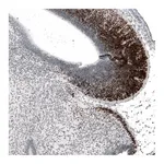 Atlas Antibodies Anti-BARHL1 Antibody