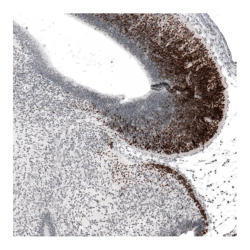 Atlas Antibodies Anti-BARHL1 Antibody