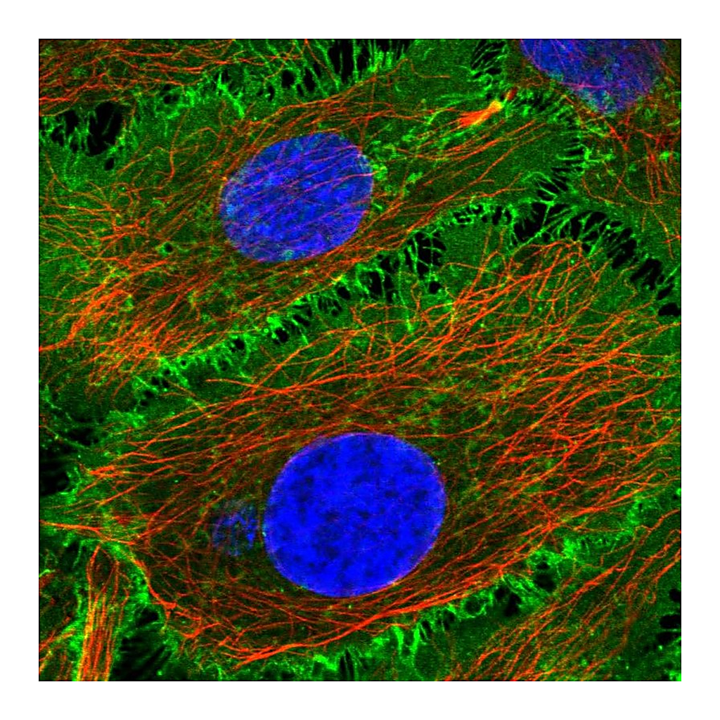 Atlas Antibodies Anti-BASP1 Antibody